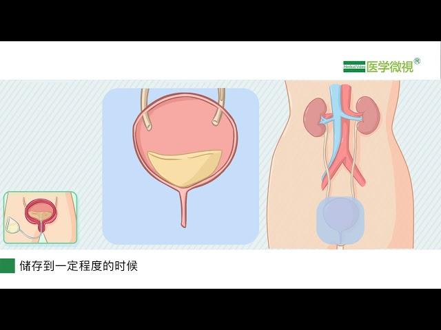 什么是神经源性膀胱功能障碍？