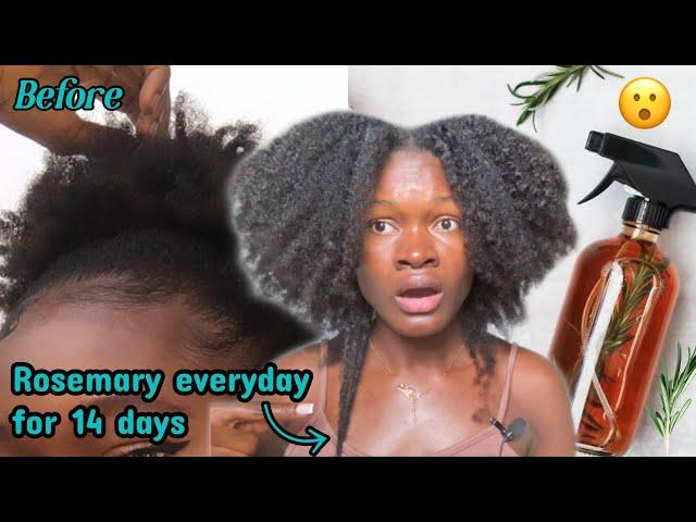 I’M still shocked ! I used rosemary on my hair everyday for 2 weeks and this happened