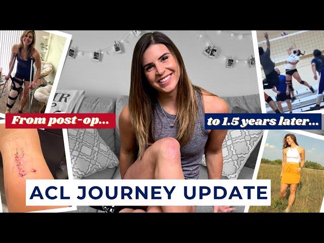 My Inspiring 1.5-Year Journey to Returning to Sports After ACL Surgery