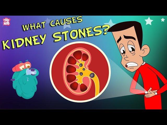 What Causes Kidney Stones? | The Dr. Binocs Show | Best Learning Videos For Kids | Peekaboo Kidz