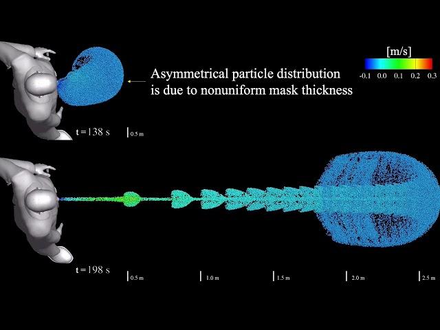 Lagrangian analysis of saliva particle transport during normal breathing