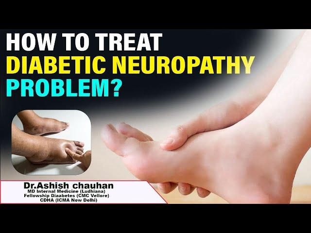 What is Diabetic Neuropathy | Symptoms , Causes & Treatment | Socialpost Healthcare