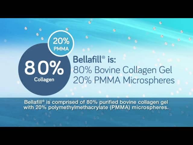 Bellafill® for Acne Scar Proposed Mechanism of Action