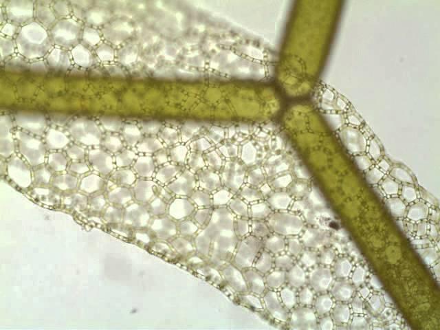 Hydrodictyon, a net-like green alga