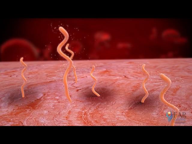 Actions of Lyme Spirochetes (Borrelia Burgdorferi)