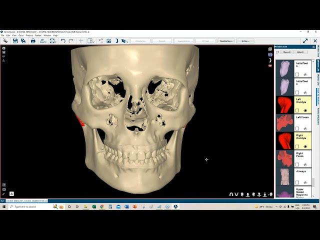 Webinar Orthodontics _The best solution for your Ortho treatments_English