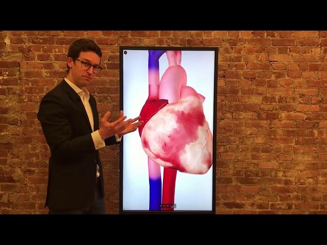 What is Cryoablation? - Dr. Tom Talks