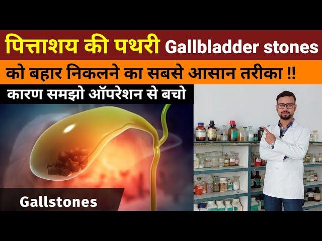 Gallbladder ki pathri ko bahar nikalne ka Aasan tarika | Gallstones symptoms, treatment, cause, diet