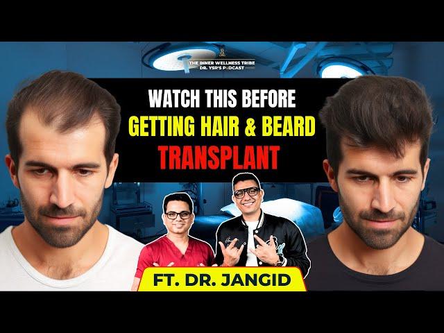 Top Hair Transplant surgeon reveals industry secrets | @HairTransplantbyDrJangid | Dr Ysr Podcast