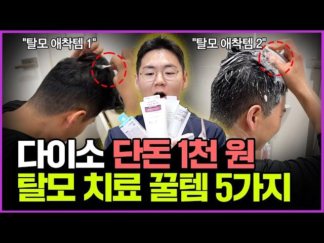 단돈 1000원으로 탈모 관리 효과를?!  탈모 전문 원장도 사용하는 다이소 꿀템 5가지 공개합니다! | 다이소 탈모 꿀템