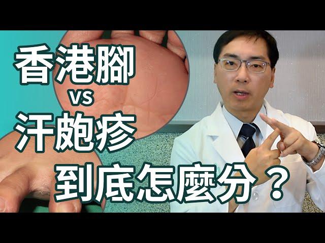 香港腳 vs 汗皰疹，到底怎麼區分？