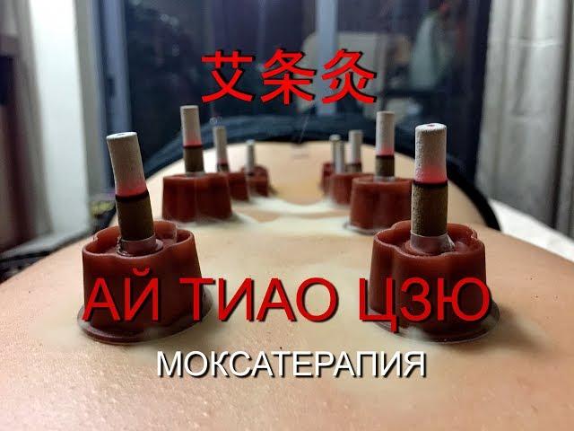 Ай Тиао Цзю - Моксатерапия  методики Традиционной Китайской Медицины Загальский Павел