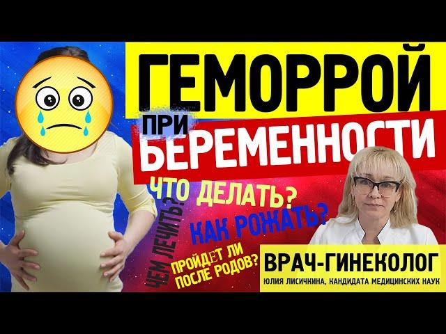 Как и чем лечить геморрой при беременности: рассказывает врач акушер-гинеколог, к. м. н.