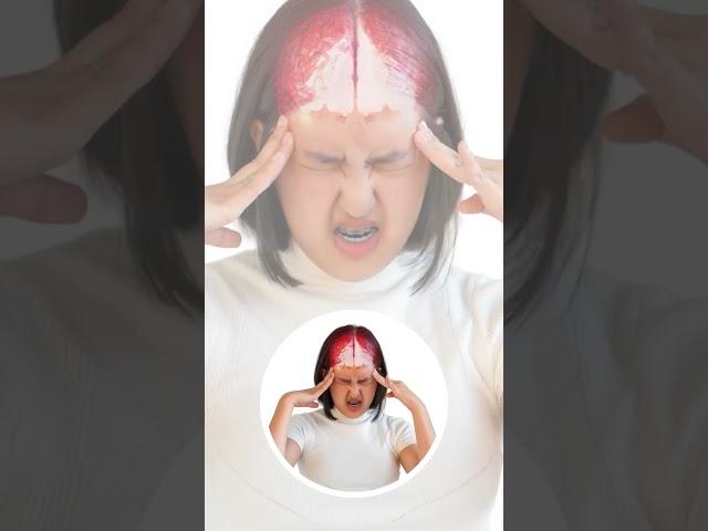 Dispelling the Myths About Brain Hemorrhages