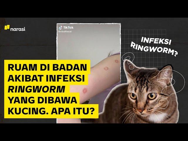 Ruam di Badan Akibat Infeksi Ringworm yang Dibawa Kucing. Apa Itu? | Narasi Daily