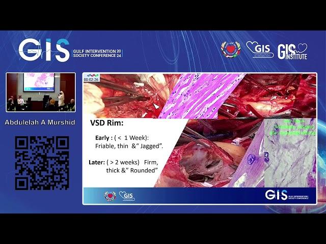 Abdulelah A Murshid - Post MI VSD Closure  A Call for Interventional Expertise