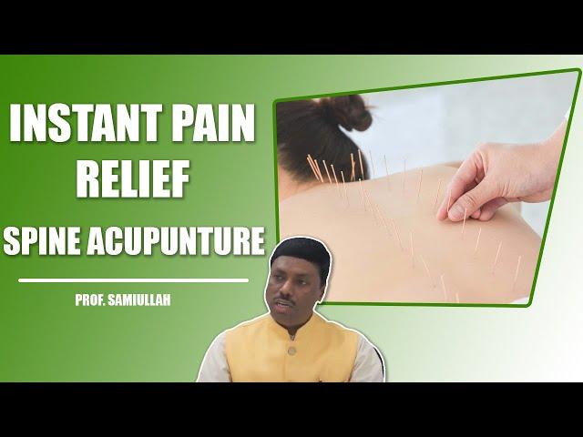 Instant Pain Relief by Acupuncture the Spine - Lower Back Pain | Prof. Samiullah