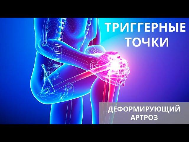Триггерные точки и деформирующий артроз