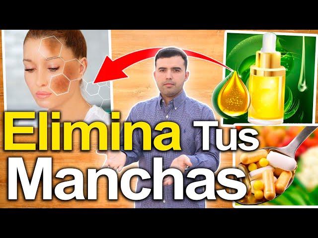 Esto Elimina Las Manchas En 1 Semana - Cómo Eliminar Las Manchas Y Blanquear La Piel En Casa