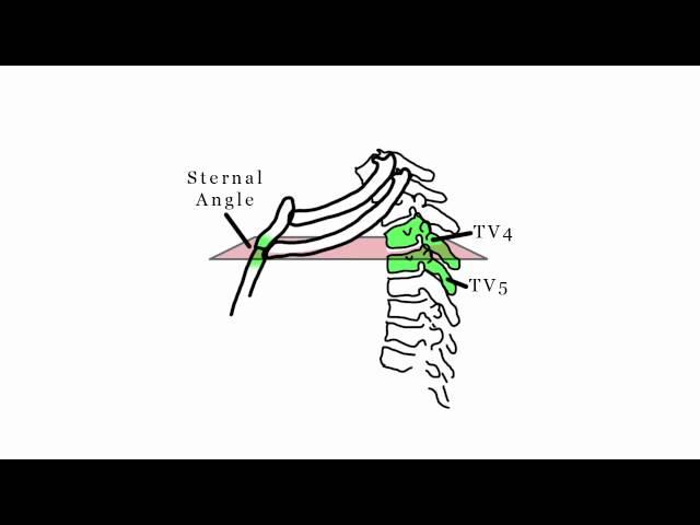 Thoracic Plane Jovicagram