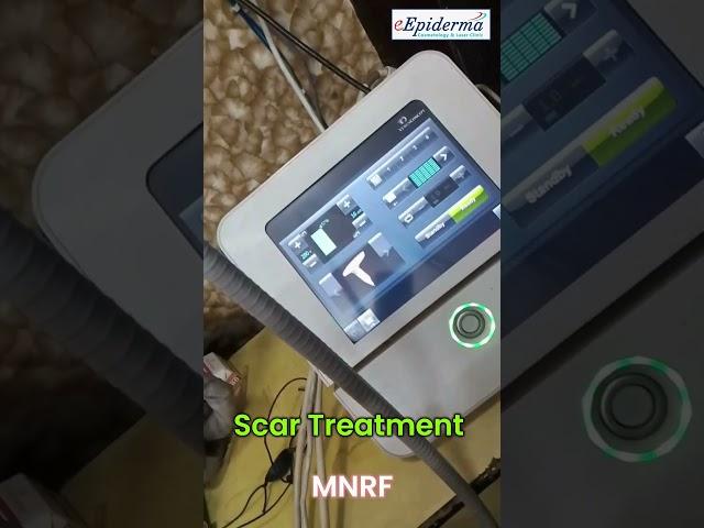 Say Goodbye to Hair Scars! First Time in Durgapur – Advanced Hair Scar Treatment at eEpiderma ‍