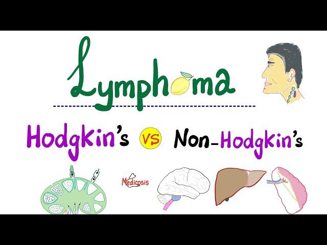 Hodgkin’s Lymphoma vs Non-Hodgkin's Lymphoma - Comparison - Hematology and Oncology