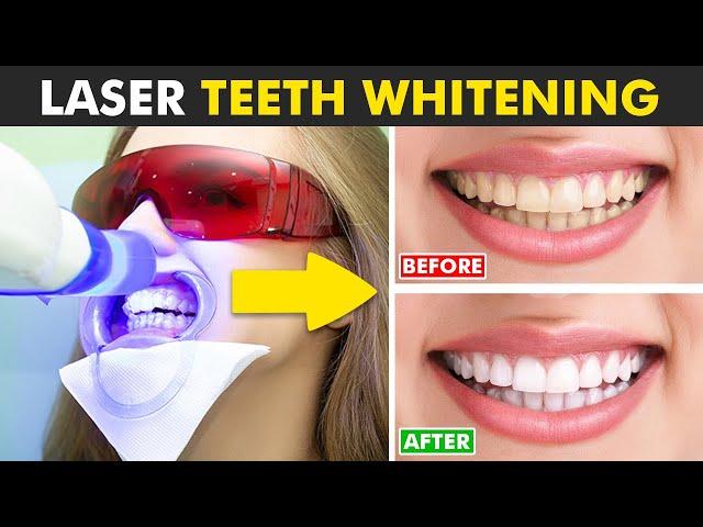 Laser Teeth Whitening Procedure