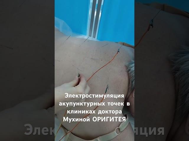 #рефлексотерапия #иглорефлексотерапия #иглоукалывание #иглотерапия #акупунктура #клиникаоригитея
