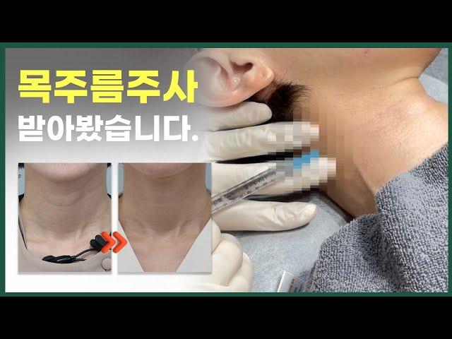 목주름 없애는 방법? 피부과에선 이렇게 합니다