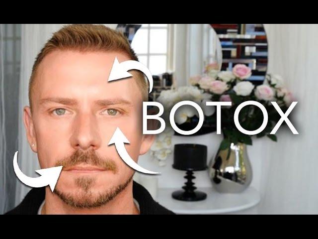 THIS IS WHAT BOTOX LOOKS LIKE - IN REAL LIFE - ON ME