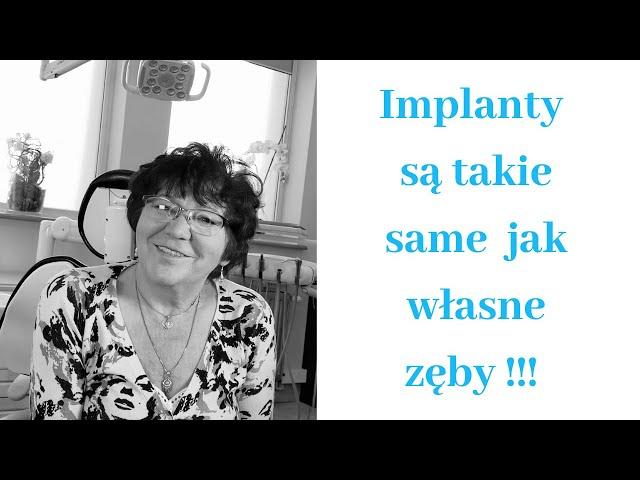 Imlanty są takie same jak własne zęby ! - opinia pacjentki. Stomatologia na Podzamczu - Szczecin