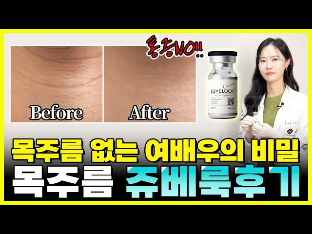 피부나이테 목주름 없애는 방법? 여배우도 했다는 목주름 쥬베룩 후기! 부천쥬베룩, 부천피부과