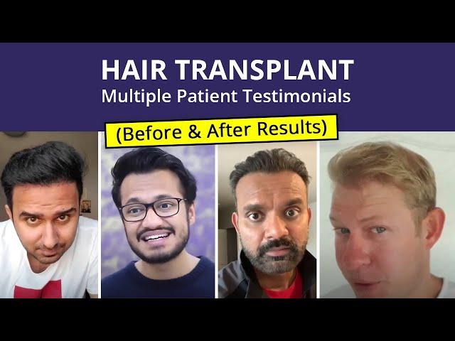 Hair Transplant - Patient Reviews | Medlinks | Before & After Results | Multiple Client Testimonials