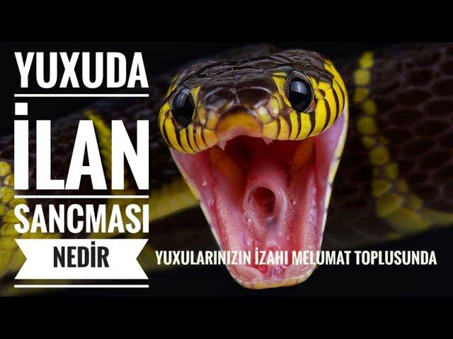 Yuxuda ilan sancması ne demekdir - Yuxuda ilan gormek #yuxuyozmalar #melumattoplusu