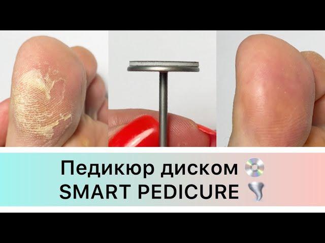 Педикюр диском  Smart pedicure  аппаратный педикюр