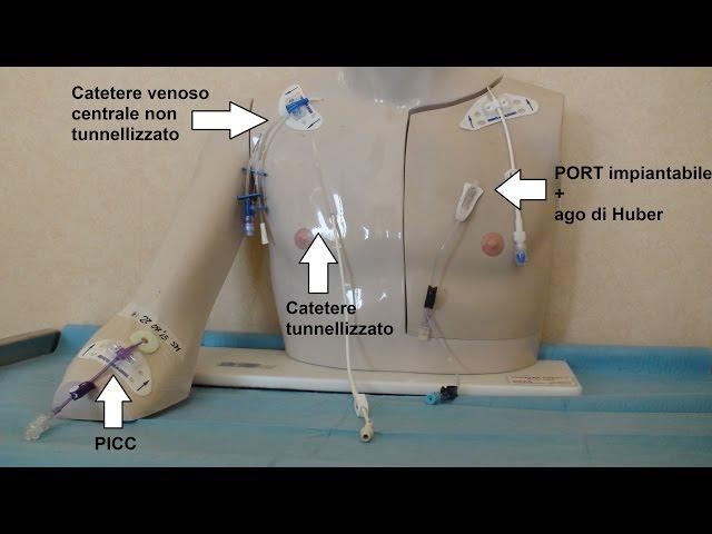 I cateteri venosi centrali