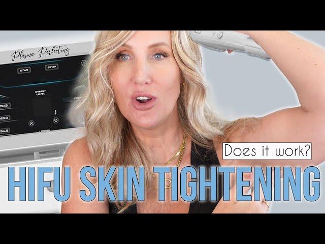 HIFU Skin Tightening - Does it Work? #hifutreatment