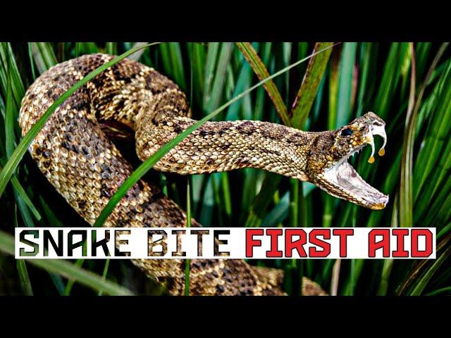 Snake Bite First Aid