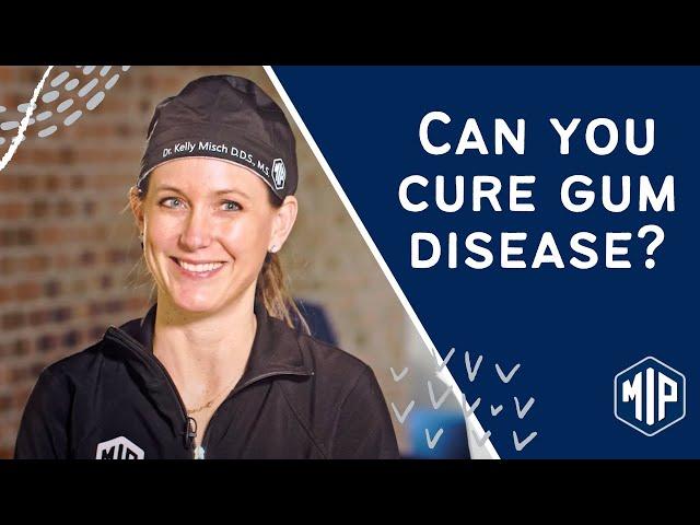 Can You Cure Gum Disease Without A Periodontist?