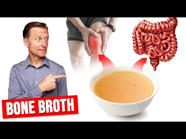 Why Bone Broth Is Really Used for Gut Issues and Arthritis