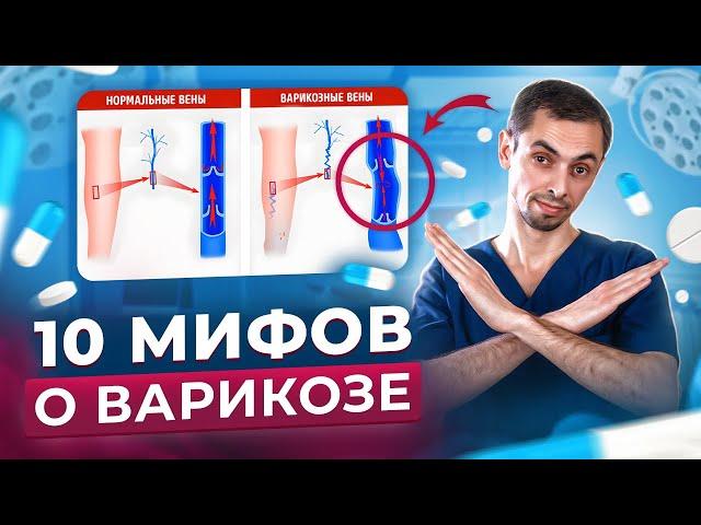 10 ЛОЖНЫХ ФАКТОВ О ВАРИКОЗЕ / КАК ВАС РАЗВОДЯТ НА ДЕНЬГИ/ ФЛЕБОЛОГ