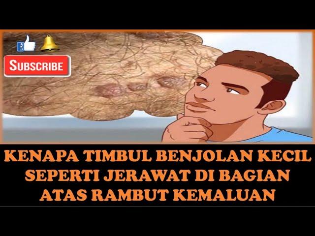 KENAPA TIMBUL BENJOLAN KECIL SEPERTI JERAWAT DI BAGIAN ATAS RAMBUT KEMALUAN