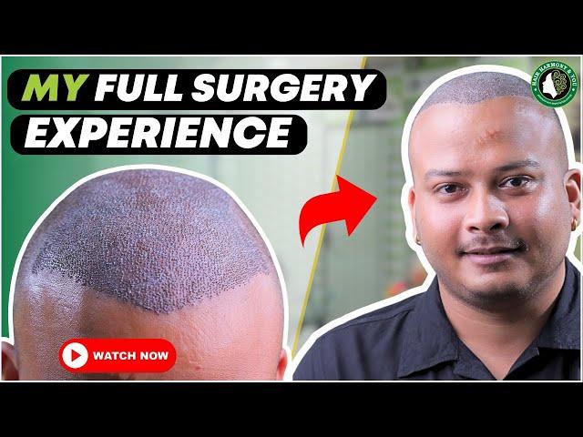 Best Hair Transplant in Guwahati | Best Hair Transplant Result & Cost in Guwahati