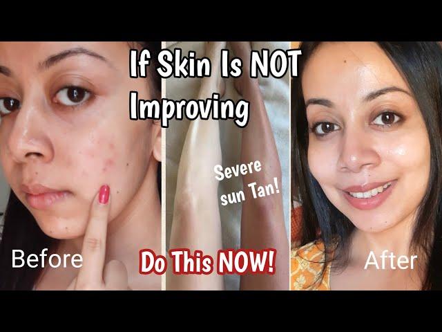 Why Skincare Products Are Not Working! | Skincare Mistakes