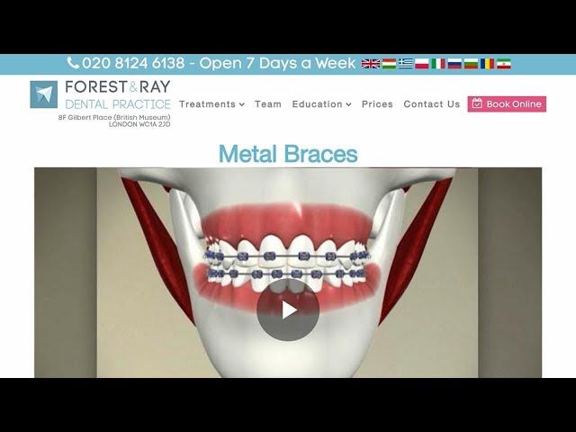 Metal Braces London - Forest & Ray - Dentists, Orthodontists, Implant Surgeons