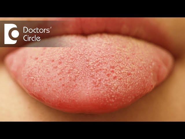 What causes small red patches on tongue? - Dr. Sana Taher