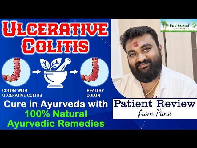 Ulcerative colitis Cure in Ayurveda with 100% Natural Ayurvedic Remedies | Patient Review from Pune