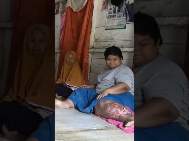 Rohiman || semoga lekas sembuh #pedulisesama #kesehatan #puskesmas #polripresisi #viral #video