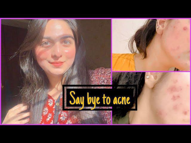 Get rid of acne permanently|best medicated acne treatment at home|why we use tretinoin?