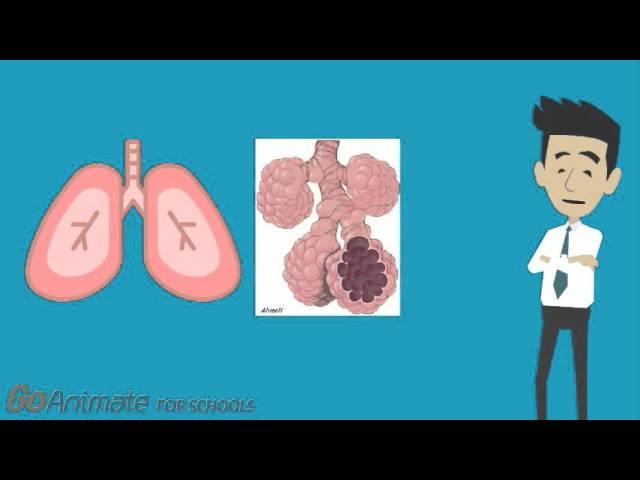 Pulmonary Fibrosis and Systemic Sclerosis